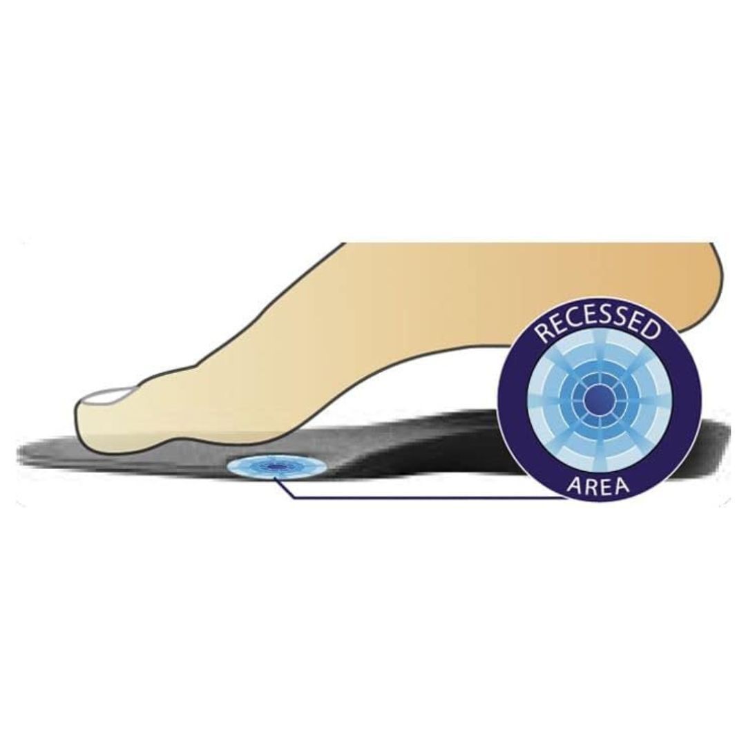 DonJoy Arch Rival Orthotic Inserts Size B (Size: Men's 6.5 - 7/Women's 6.5 - 8)