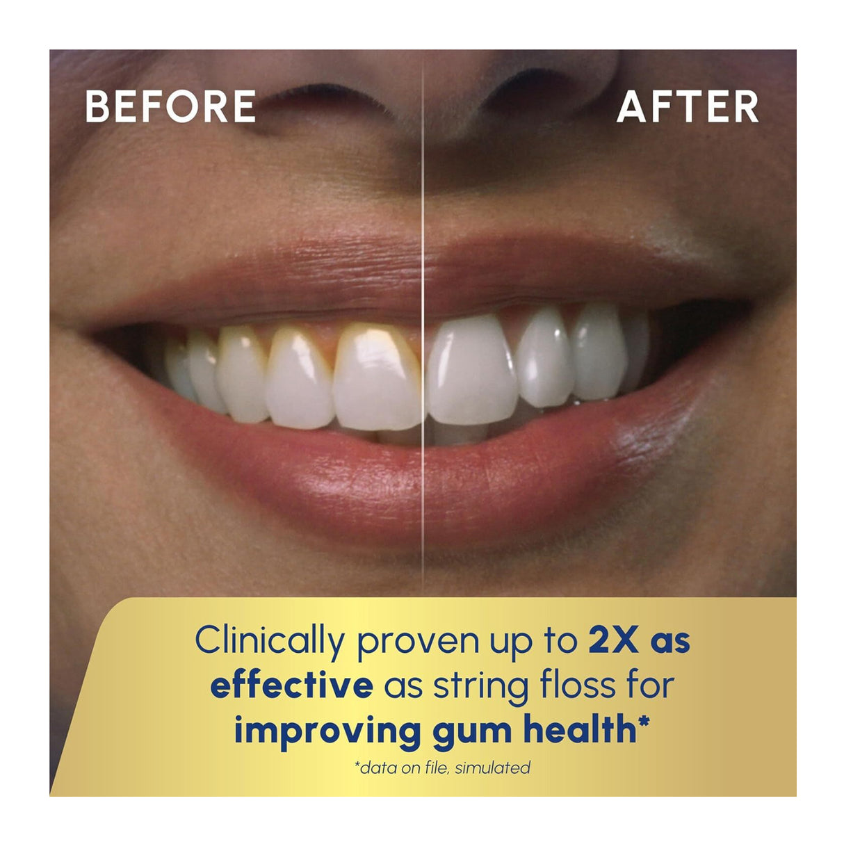 Waterpik Cordless Advanced 2.0 Water Flosser With Travel Bag (Black)