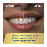 Waterpik Cordless Advanced 2.0 Water Flosser With Travel Bag (Black)